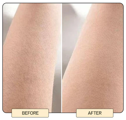IPL Laser Hair Removal Device